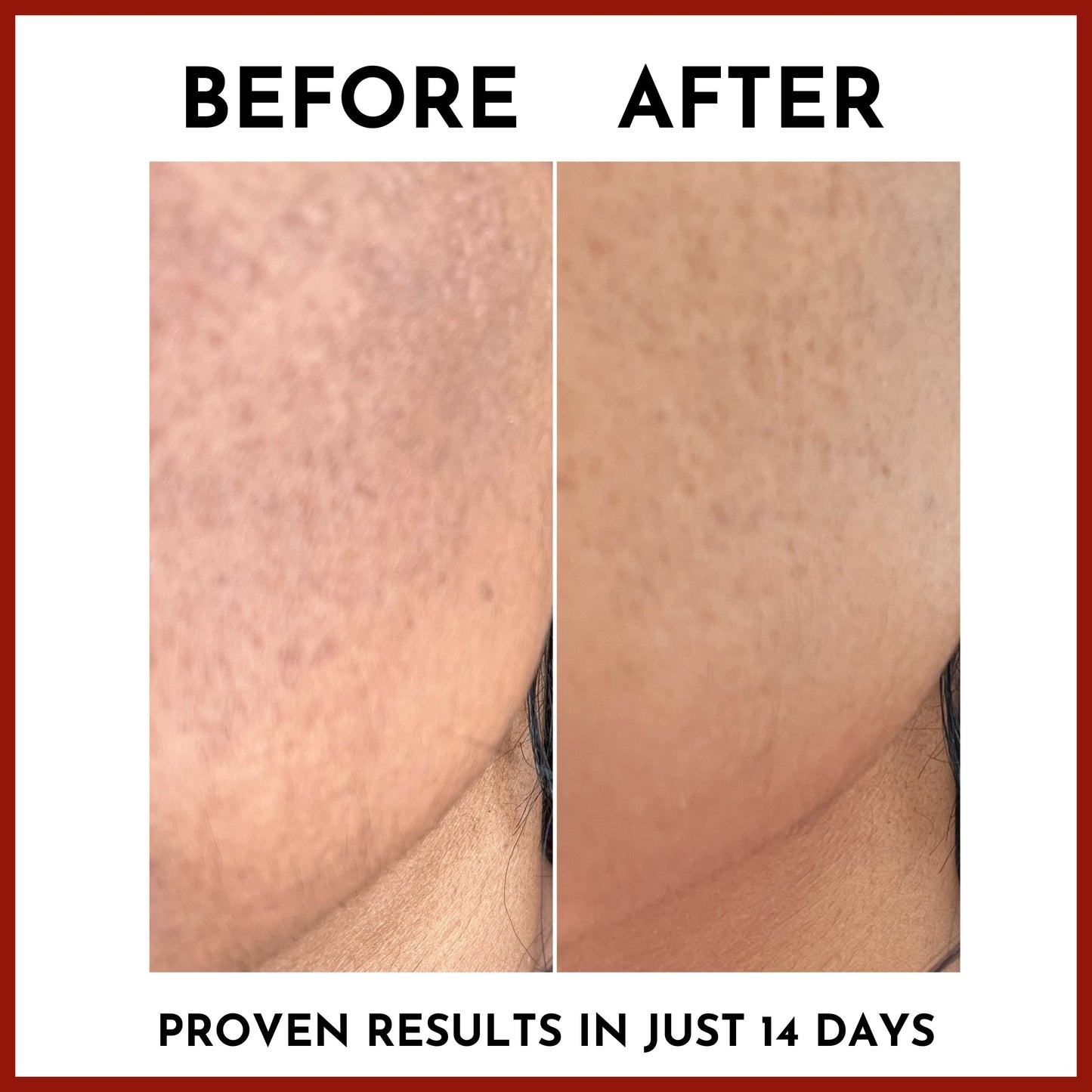 Before and After
Proven results in just 14 days