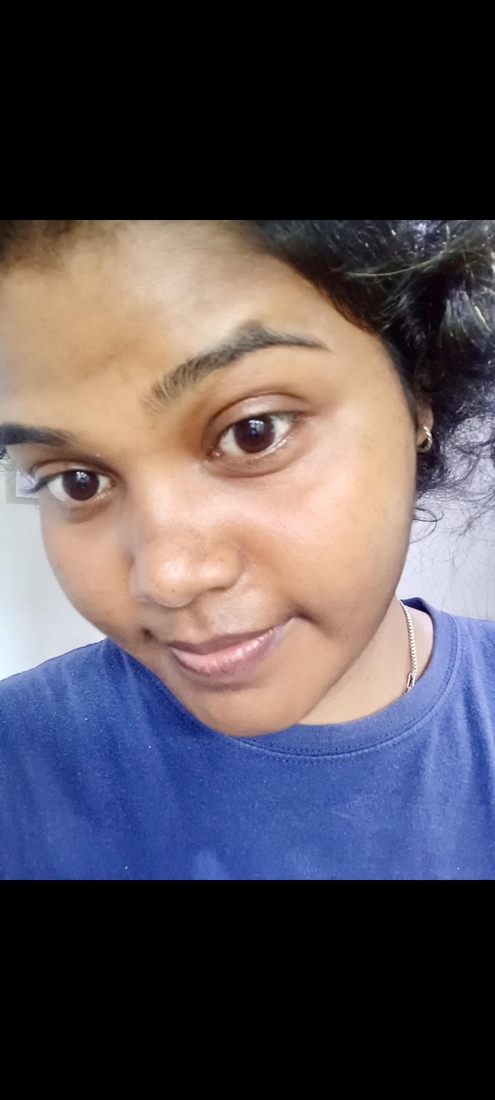 Pigmentation and dullness before and after 10 days of LUMAÈ astaxanthin night cream