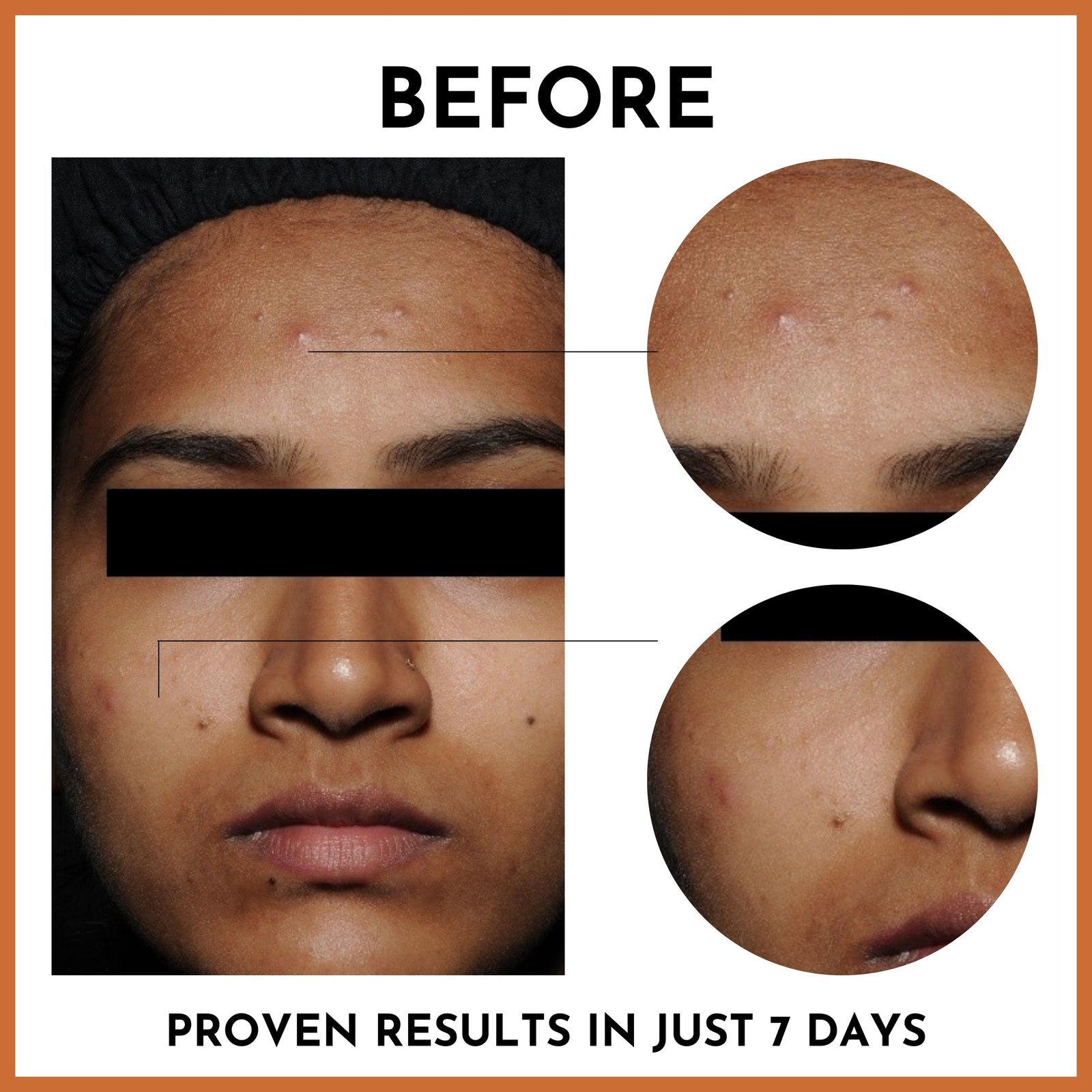 Before and after - proven results in just 7 days