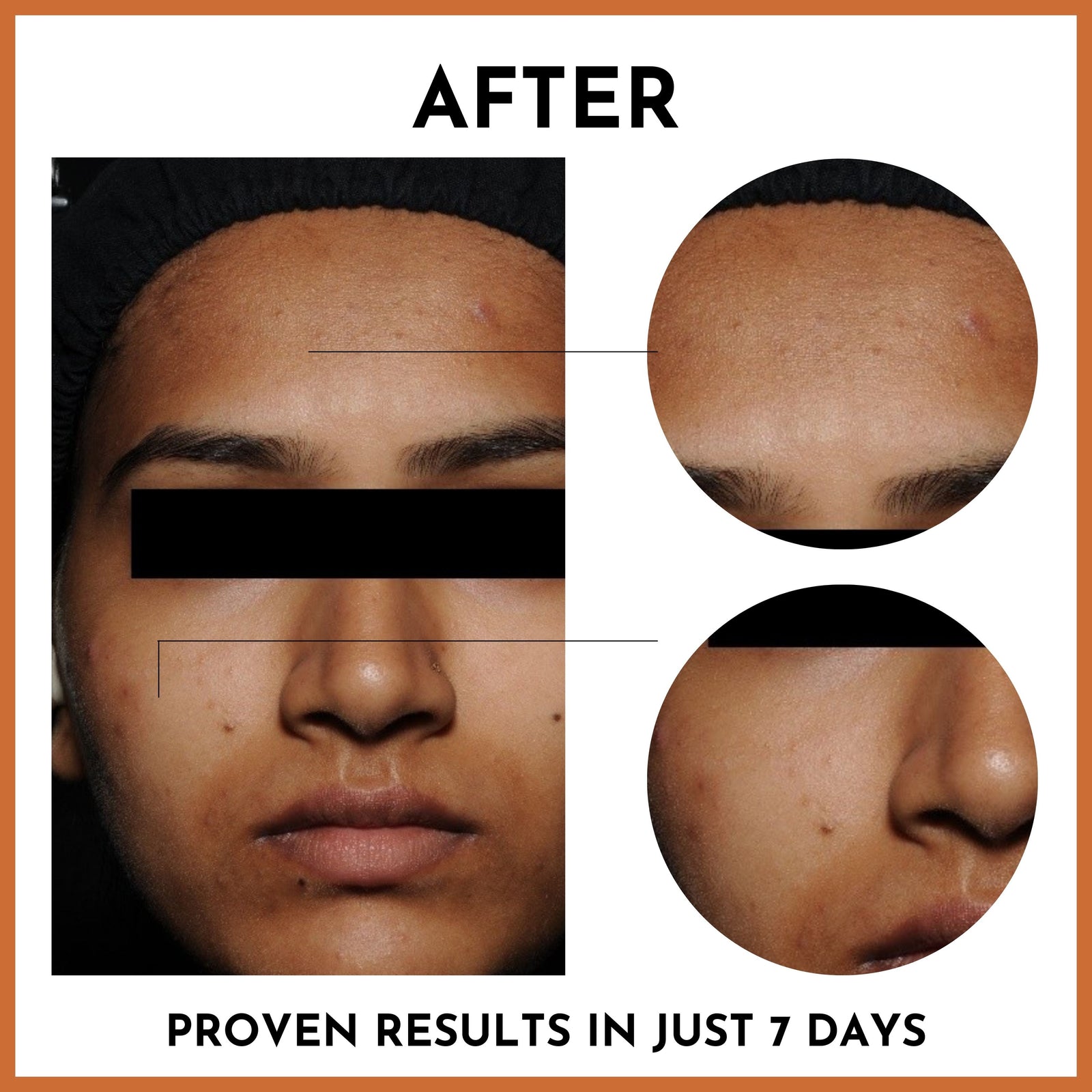Before and after - proven results in just 7 days