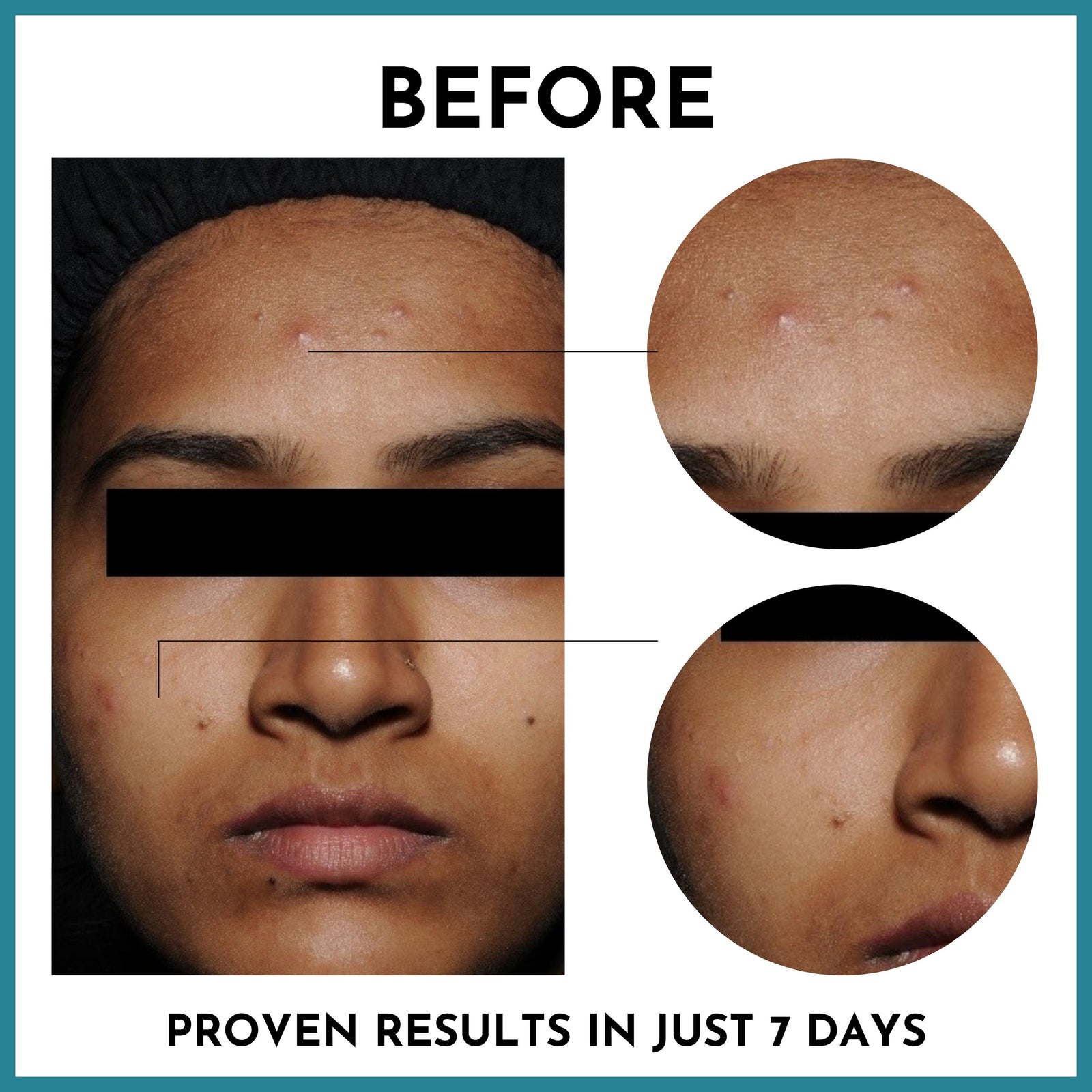 Before and after
Proven results in just 7 days