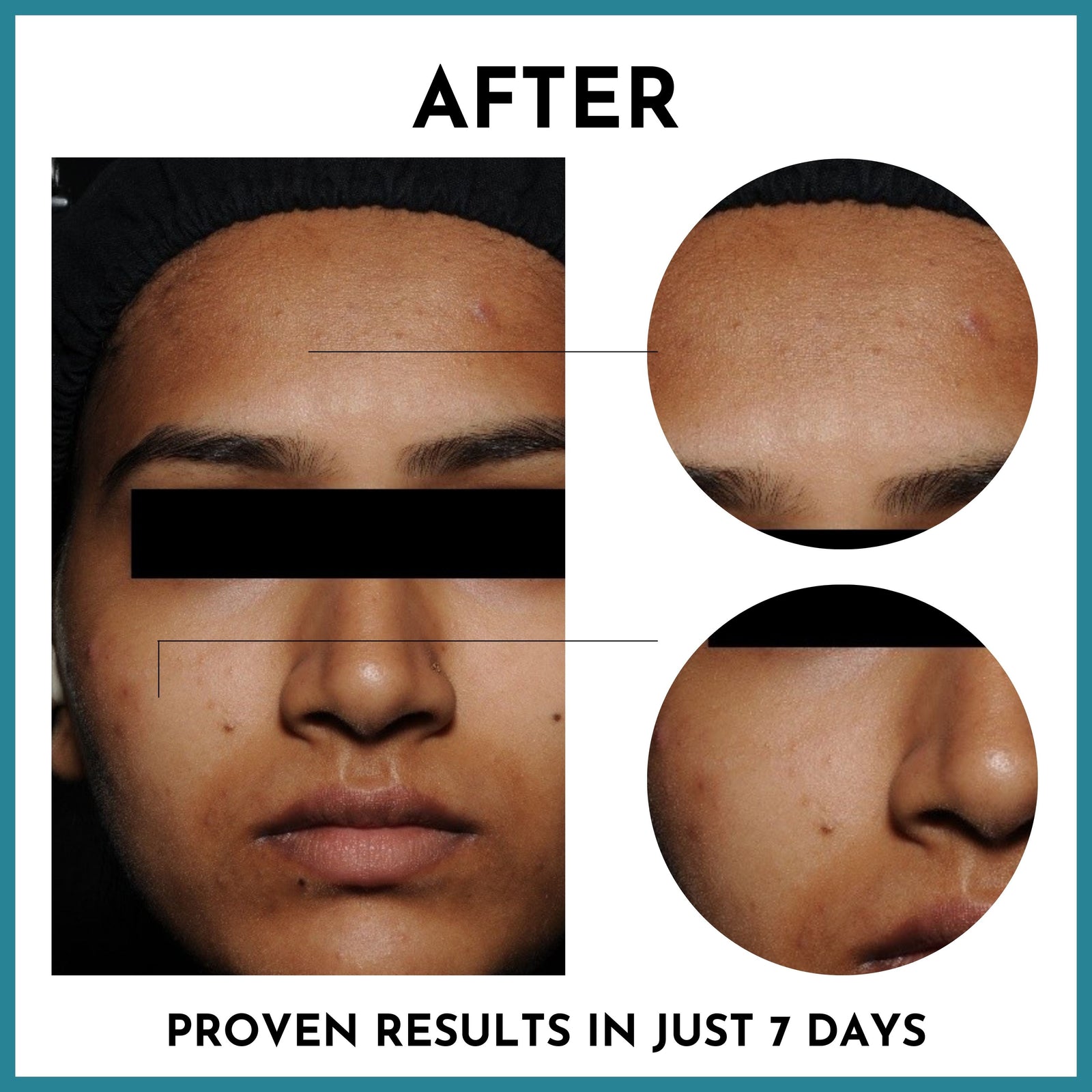 Before and after
Proven results in just 7 days